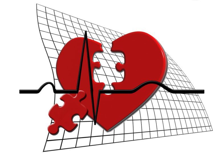 EKG současnosti – na mnohem vyšší úrovni